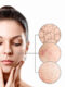 acne scars, bacne scars, best way to get rid of acne scars